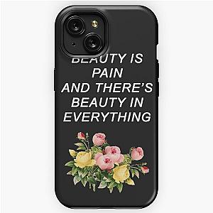 Alessia Cara Cover iPhone Tough Case