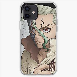 Dr. Stone Cases - Senku - Stone iPhone Soft Case RB2805