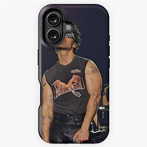 Joe Jonas iPhone Case