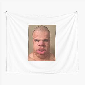 Tyler1 fixed Tapestry