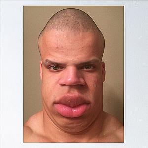 tyler1 fixed poster