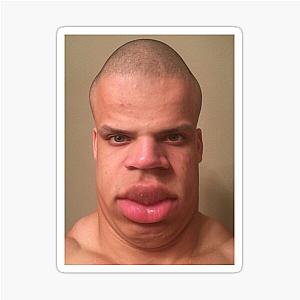 Tyler1 fixed Sticker