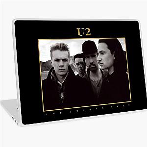 THE Laptop Skin